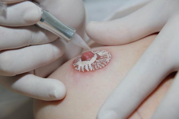 Imagem da internet (2)